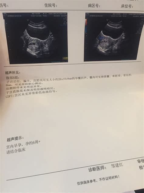 孕囊形状看男女(超准)，看6-7周的3个数据(长条是男/圆形是女) — 爱达夫养生