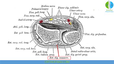 Image result for Extensor Digitorum Communis Surgery