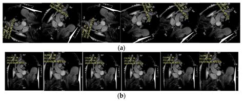 MyI-Net: Fully Automatic Detection and Quantification of Myocardial ...