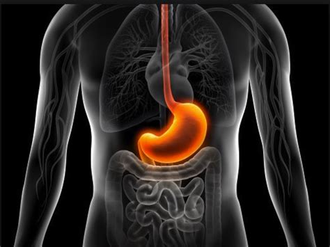 ¿Qué es la gastritis? - Dr Onofre Alarcón. Médico Especialista Aparato Digestivo. Santa Cruz de ...