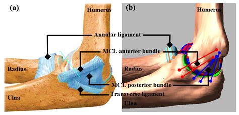Ulnar Collateral Ligament Elbow