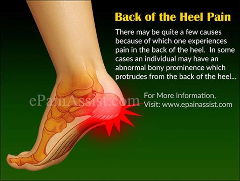 Pin on Foot Pain,Causes, Treatment.