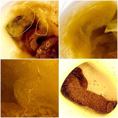 Does this look like candida in my stool? Been trying to figure out what ...