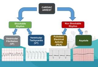 Cardiac Arrest Rhythm.pdf