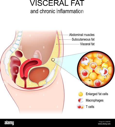 What Increases Visceral Fat
