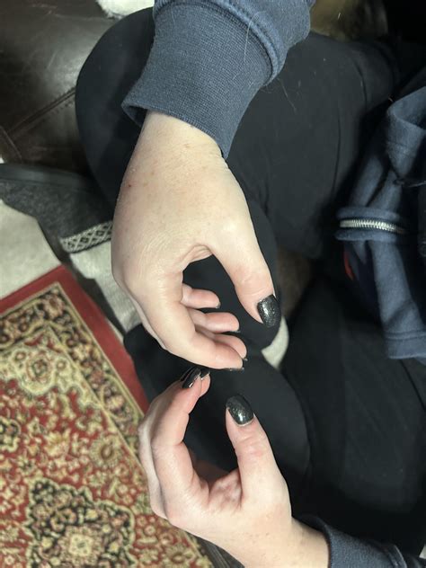 7 lbs of terror: she bit me 12 hours ago. Had to go to the ER. : r ...