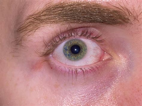Not sure what color to consider my eyes? : r/eyes