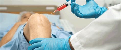 Health Canada Approves Abbott’s Dissolvable Stent for Below-the-Knee ...