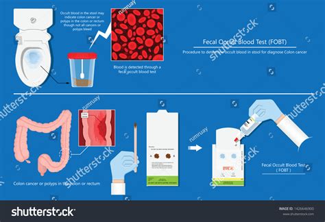 Positive Fecal Occult Blood Test