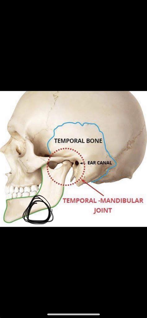 pain on left side of jaw when i touch it : r/TMJ