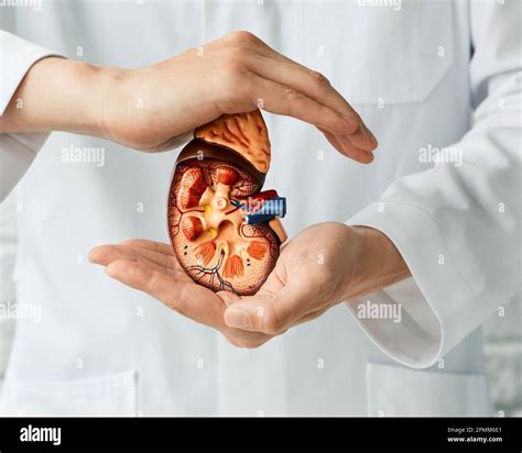 medical care of kidney disease. doctor holding anatomical model of kidneys in hands Stock Photo ...