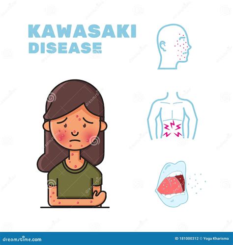 Kawasaki Disease Symptoms. Common Signs Of Kawasaki Syndrome Royalty-Free Illustration ...
