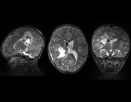 Cube | GE HealthCare (India)