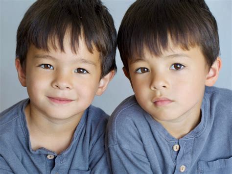 Half Identical Mirror Image Twins Mixed Chromosome Twins ...