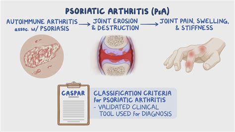 Psoriatic arthritis: Video & Meaning | Osmosis