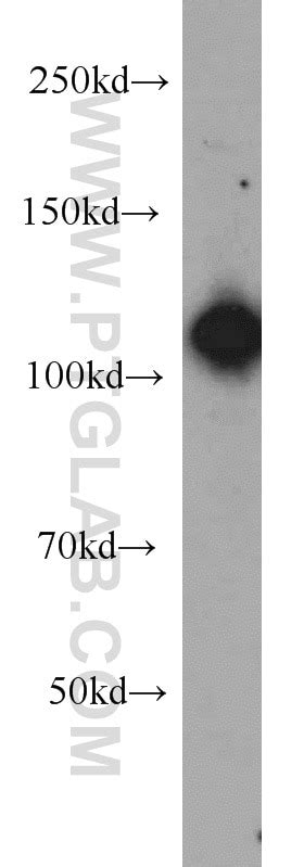EFTUD2 antibody (10208-1-AP) | Proteintech