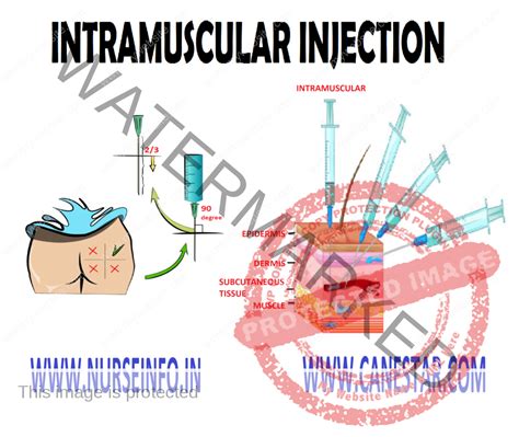 Muscle Injection 的图像结果