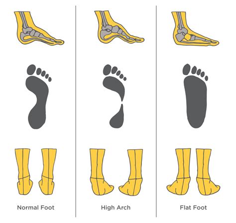 A Podiatrist’s Running Shoe Fit Guide: Assessing Arch, Gait, and Stride ...