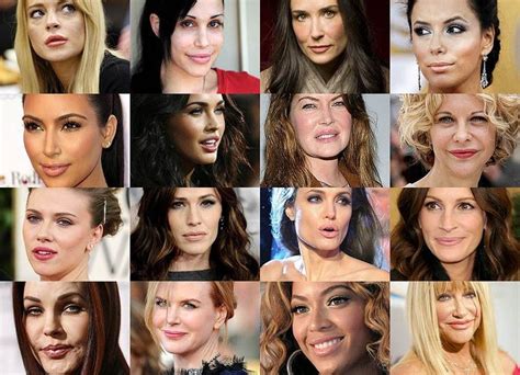 Kuvatulokset haulle celebrities with lips done