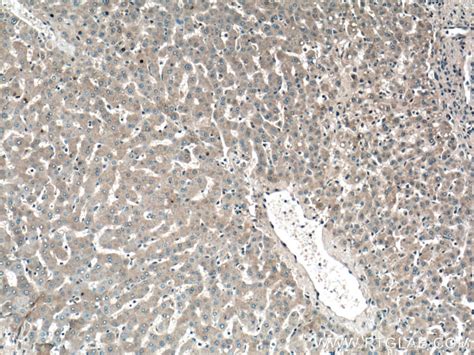 GYS2 antibody (22371-1-AP) | Proteintech