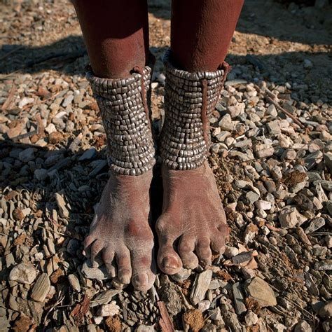 Indigenous People Foot Health and Care