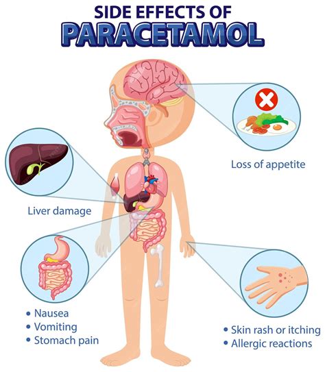 Diagrama de anatomía humana estilo de dibujos animados de efectos secundarios de paracetamol ...