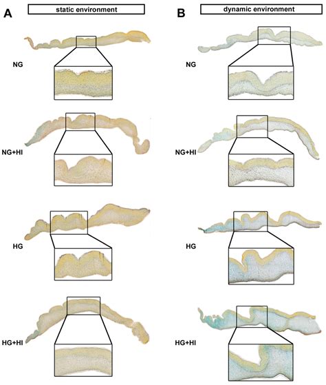 Crosstalk of Diabetic Conditions with Static Versus Dynamic Flow ...