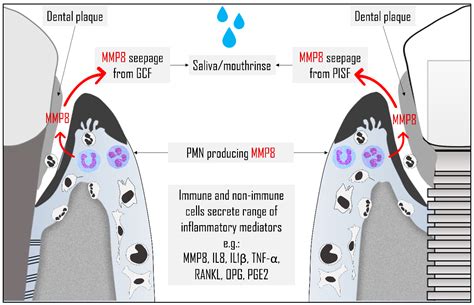 Diagnostic Accuracy of Oral Fluids Biomarker Profile to Determine the ...