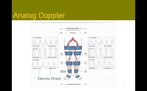 Sonographic Principles and Information Registry Review