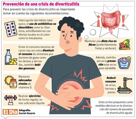 Diverticulitis en el colon y la importancia del reposo digestivo