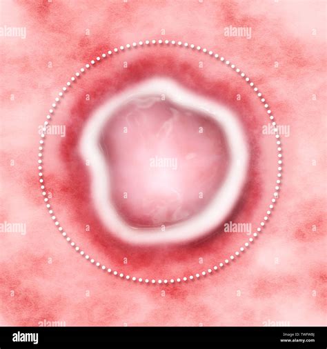 Sore mouth disease hi-res stock photography and images - Alamy