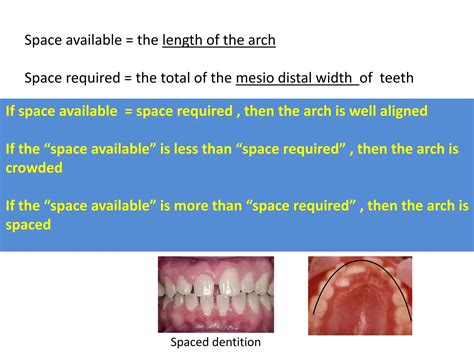Study Cast Analysis Lac for 4th level1 .pptx