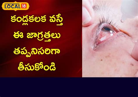 Conjunctivitis: భయపెడుతున్న కండ్లకలక.. ఈ జాగ్రత్తలు తప్పనిసరి.. హోం ...