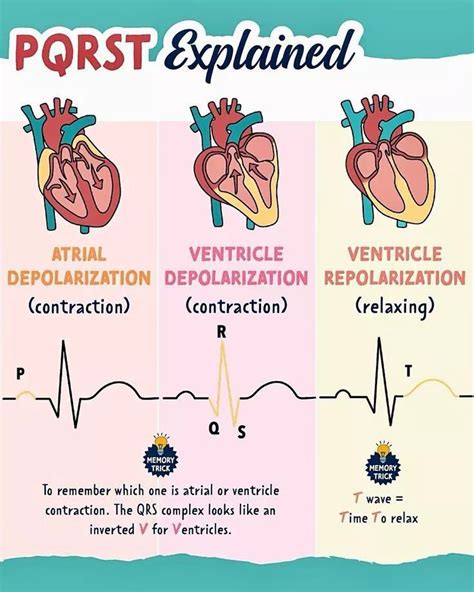 Basic ECG Rhythms 的图像结果