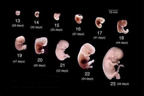 产检发现胎儿偏小1-2周，可能有3种情况，偏小会让宝宝推迟出生吗_腾讯新闻