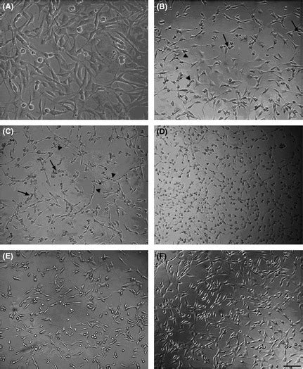 H2O2 HT22 的图像结果