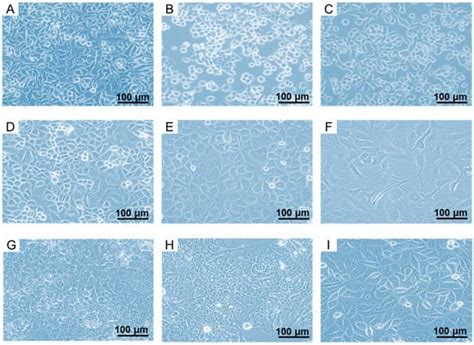 Folate Receptor-Positive Gynecological Cancer Cells: In Vitro and In ...