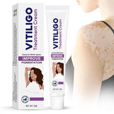 HSKLOCK Crema de vitíligo, tratamiento de vitiligo para reducir las ...