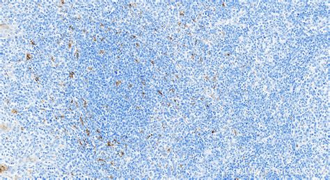 CD68 antibody (84596-4-RR) | Proteintech