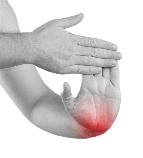 Carpal Tunnel Release | Synergy Health Partners