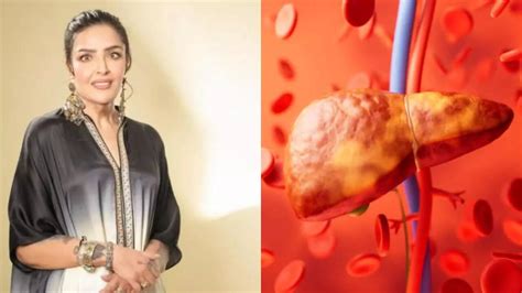 Hrithik Roshan’s Sister Sunaina Reveals Hacks On How She Reversed Grade ...