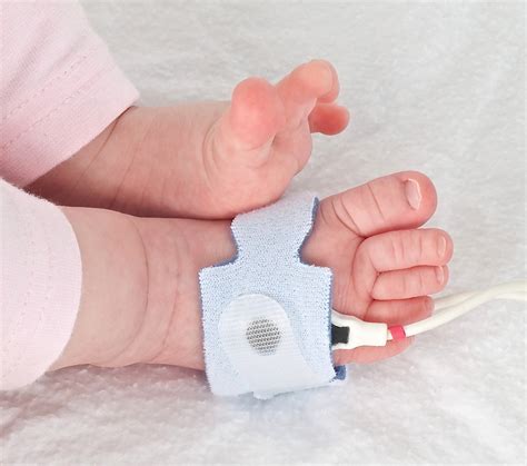 Starship - Pulse oximetry screening to detect critical congenital heart ...