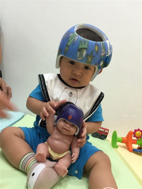 Ortho Helmets For Babies at Margaret Ratliff blog