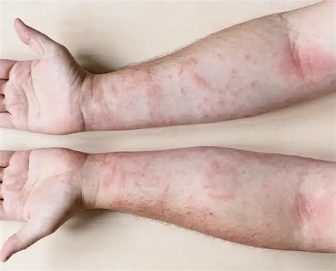 General Dermatology | DermoRita Skin Clinic