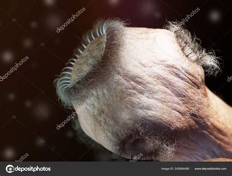 Tapeworm Under A Microscope