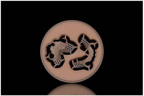 Removable Partial Denture Frameworks in the Age of Digital Dentistry: A ...
