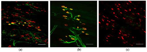 A Therapeutic Strategy for Lower Motor Neuron Disease and Injury ...