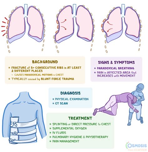Paradoxical Breathing Yoga Anatomy: How Your Breathing Pattern Affects