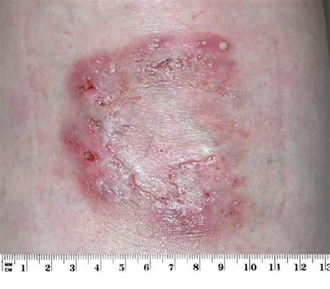 Sore Legs From Leg Day at Russell Torres blog