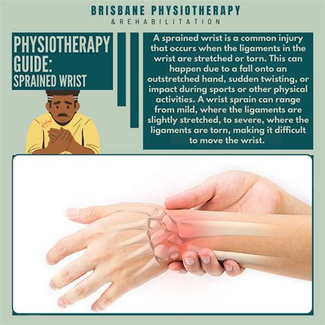 Sprained Wrist: Understanding the Injury and How Physiotherapy Can Help ...